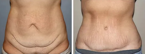 Coco Ruby Plastic Surgery | Plastic Surgeons Melbourne - 25